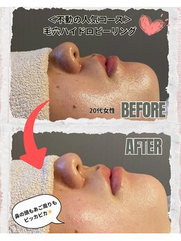 ボーテドゥマリエ(beaute de mariee)/毛穴ケアならハイドロ