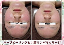 痩身 アンド バスト専門サロン プラナ 町田店(PRANA)