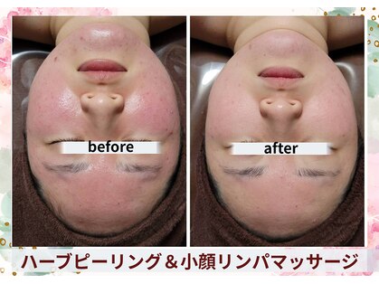 痩身 アンド バスト専門サロン プラナ 町田店(PRANA)の写真
