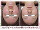 痩身 アンド バスト専門サロン プラナ 町田店(PRANA)の写真
