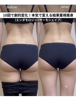 アスエ(ASUE)の写真/【人気No.1】痩せにくい下腹・腰肉・太ももに!大人女性の本気痩身