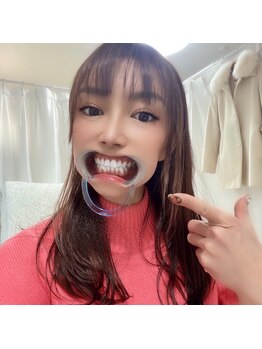 ライトビューティー 銀座店(LightBeauty)/ホワイトニングで第一印象アップ