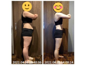 美容整体院元 光の森店/ダイエット6ヵ月 before&after