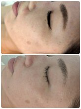 ビエストラ(Biestora)/