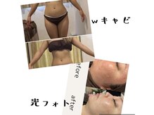 ビューティー エイム(Beauty aim)の雰囲気（夏に向けてボディメイクは優秀ｗキャビでボディメイク◎）