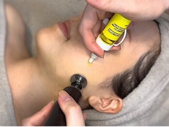 ラ ムールの写真/【韓国発最新美容】話題の脂肪分解レモンボトル・DT無し！夏に向けてすっきりフェイスラインが実現♪