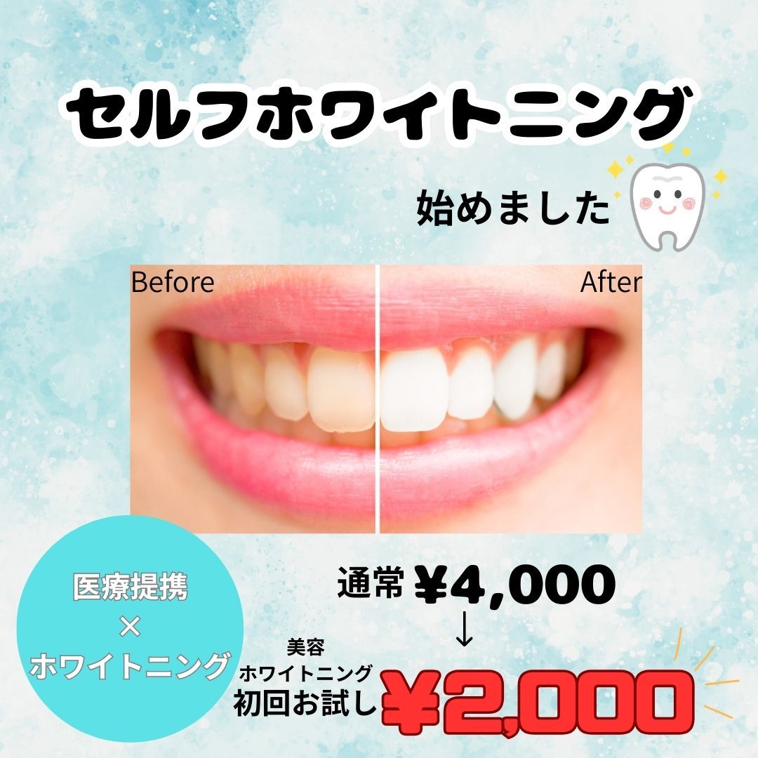 【セルフホワイトニング】8分×2　通常￥4,000→初回￥2,000