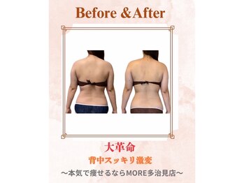 モア 多治見店(MORE)/お客様ビフォーアフター♪