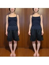 テマモリ(temamori)/施術ビフォーアフター