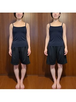 テマモリ(temamori)/施術ビフォーアフター