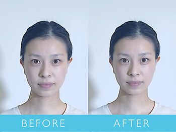 ビューティーマジック 恵比寿 広尾(beauty magic)/小顔矯正術 頭顔骨コース1回