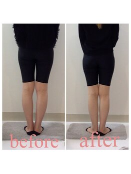 スタイルラボ高松/産後骨盤矯正の効果♪