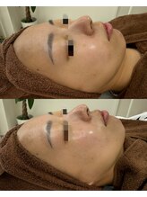 レイ(Lei)/紫外線リセットにも♪