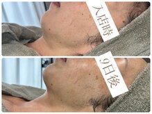 ビーエルティー(blt)/レモンボトル