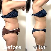 エステサロンクオーツ