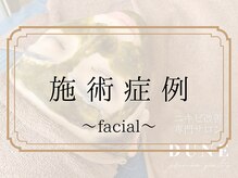 デューン 蕨店(Dune)/施術症例