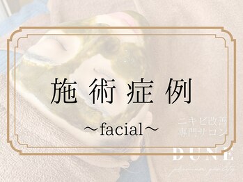 デューン 蕨店(Dune)/施術症例