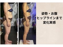 ハルハル(Haru Haru)の雰囲気（年齢とともに崩れやすいラインを深部ケア～）