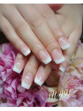 アイネイル(iNAIL)/