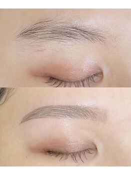 デイドット バイ リロ 札幌(de. by Liro)/Before→After