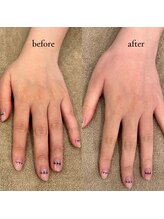 コス(KOS)/ビフォーアフター