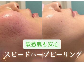 キュート 川越店(Cute)/フェイシャルメニューも充実