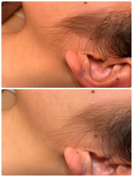 ノノ(nono)/もみあげ（Sパーツ）