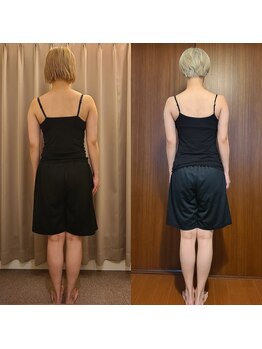 テマモリ(temamori)/施術ビフォーアフター(半年間)