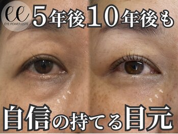 モンステラ(MONSTERA)の写真/まつげパーマ・LEDフラットラッシュ・アイパワーエステで、下がりまつ毛やくすみなど40代の目元悩みを解決
