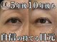 モンステラ(MONSTERA)の写真/まつげパーマ・LEDフラットラッシュ・アイパワーエステで、下がりまつ毛やくすみなど40代の目元悩みを解決