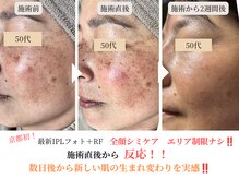 エソア(esoa)の雰囲気(京都唯一の最新シミケアで皆さんノーファンデ肌を叶えています♪)