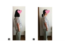 ヌフヌフ(neuf neuf)/首・肩こりの方に届けたい施術