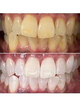 ホワイトニングサロン クルー(CREW)/男性もご来店多いです！