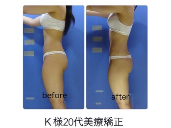 エステージ(estage)/