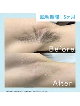 メンズクリア 高知帯屋町店/【メンズクリア】お客様の施術例