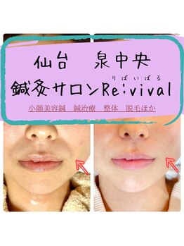 リバイバル(Re:vival)/ほうれい線にも◎