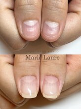 マリーロール 梅田店(Marie Laure)/深爪矯正/自爪育成/自爪風
