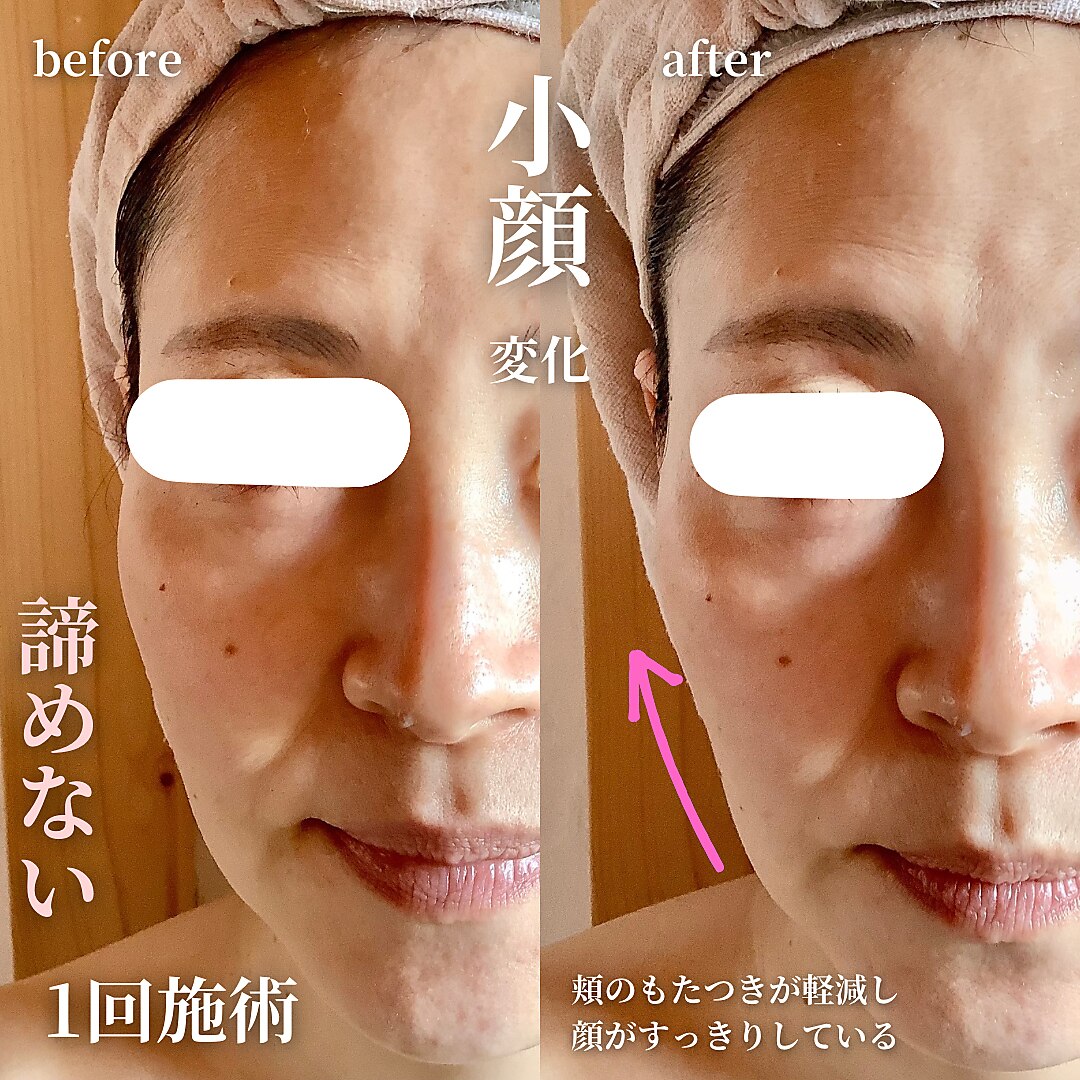 エステティックサロン ドゥネール｜ホットペッパービューティー