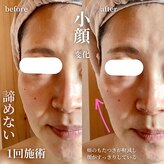 エステティックサロン ドゥネール