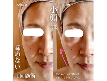 エステティックサロン ドゥネール