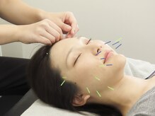 麻布十番ループル治療院/90分スポーツマッサージ＆美容鍼