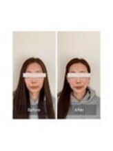 ハリラボ 仙台上杉店(hari Lab.)/【お客様の声】