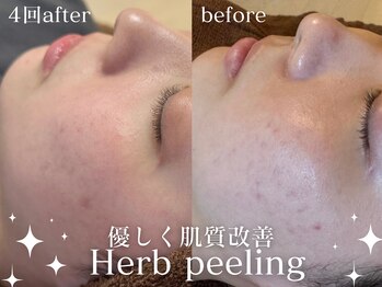 グランクウォーレ(Gran Cuore)/本気の肌質改善★