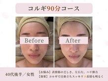 結果を重視されたい方におすすめ！本格小顔コルギ70分\7700～