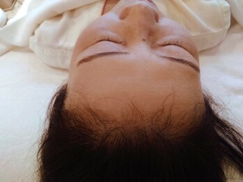 イーズ/リバイタ グランツリー武蔵小杉店/【ケース3】60代女性　after