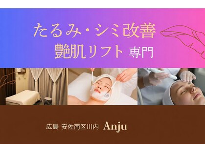 アンジュ(Anju)の写真