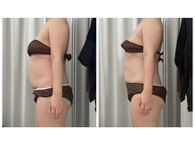 リスタ(Resta)の雰囲気(新メニューの腸デトックスコース。リンパ解放して深筋膜を刺激!)