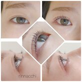 リンナッチ(rinnacchi)