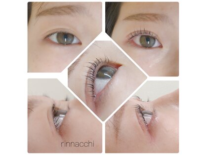 リンナッチ(rinnacchi)の写真