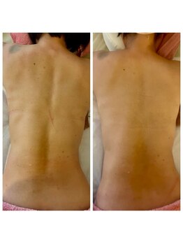 クィーンダム(Queendom)/弛んだ筋肉が引き締まる